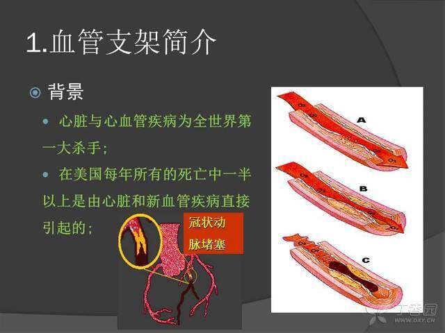 新华鲜报丨暖！人工耳蜗、外周血管支架集采开标