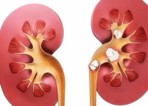 赛莱拉：启动干细胞治疗膝骨关节炎新药二期临床试验