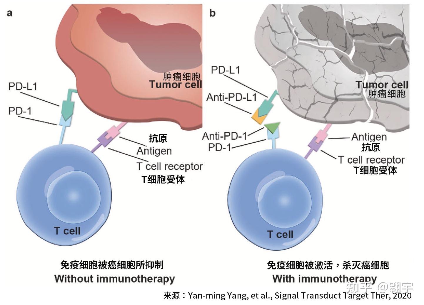 Mirxes-B：核心产品“觅小卫”获批用于胃癌筛查