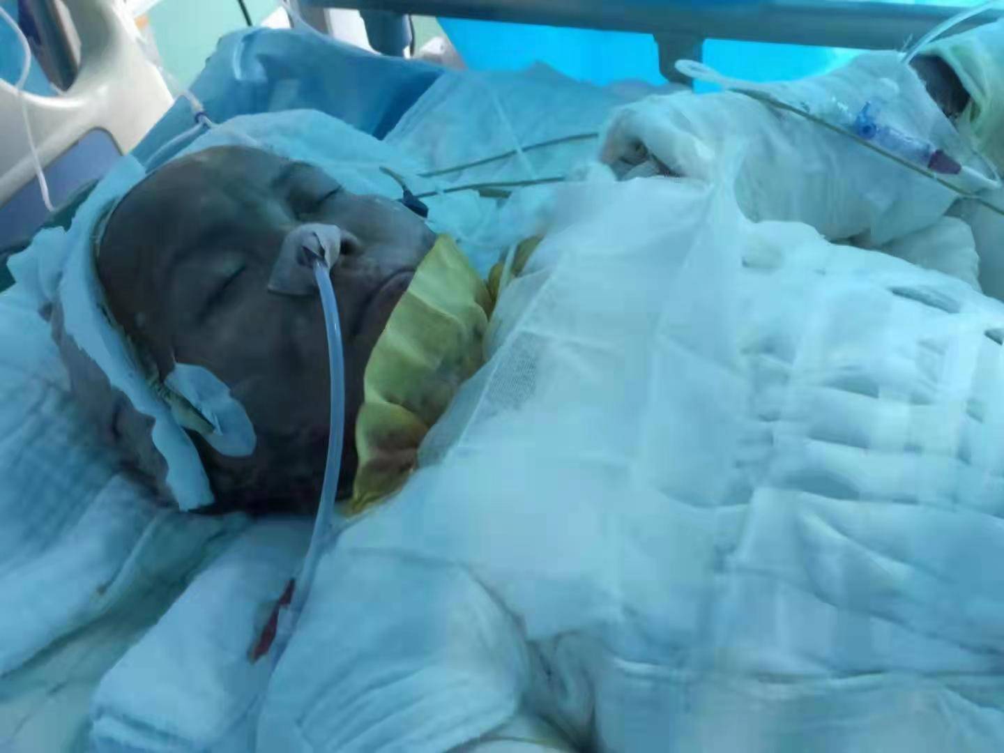 香港特区政府为火灾受影响居民提供医疗费用减免服务